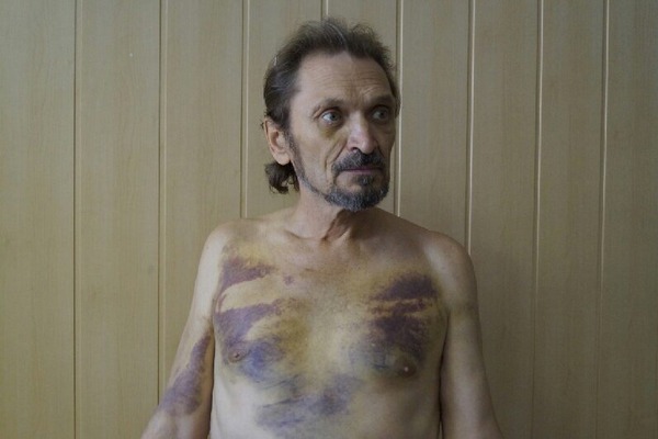 Александр Хомченко: Когда вывели на расстрел к яме, заполненной убитыми, перед глазами пролетела вся жизнь