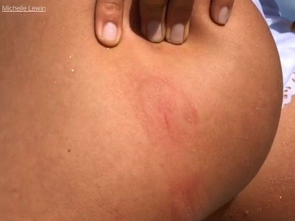 На Багамах огромная свинья укусила за ягодицу известную фитнес-модель (фото, видео)