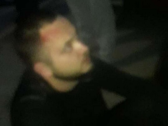 Под Киевом мужчина жестоко избил незнакомую женщину на глазах у ребенка: фото и детали происшествия