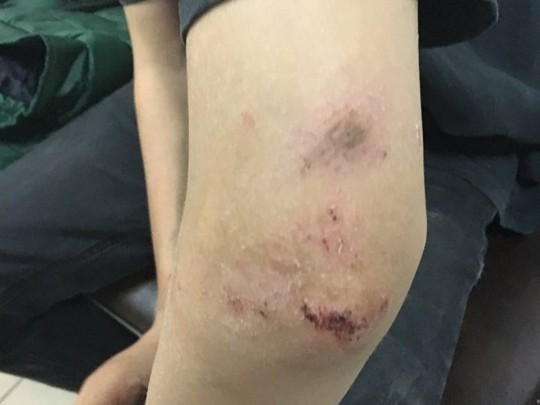 В Днепре мужчина вмешался в детскую ссору и избил подростка до больничной койки (фото)