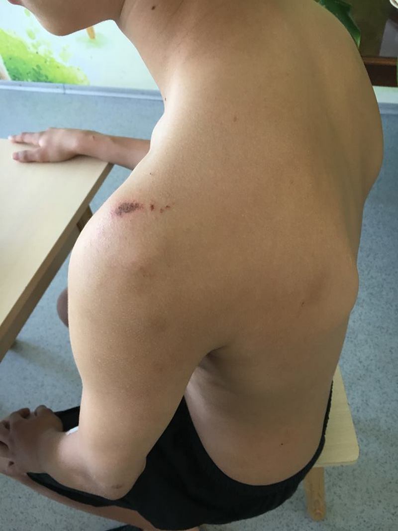 В Днепре мужчина вмешался в детскую ссору и избил подростка до больничной койки (фото)