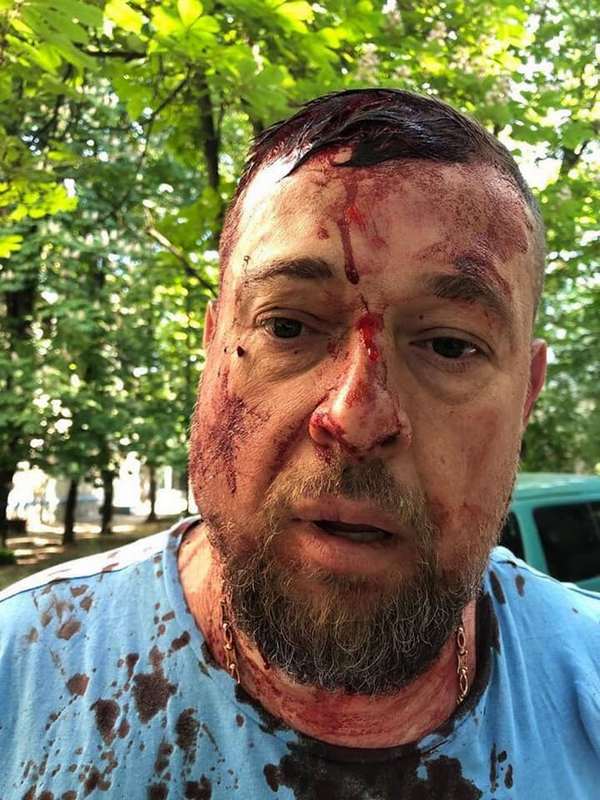 В Харькове зверски избили активиста Нацкорпуса: первые детали происшествия