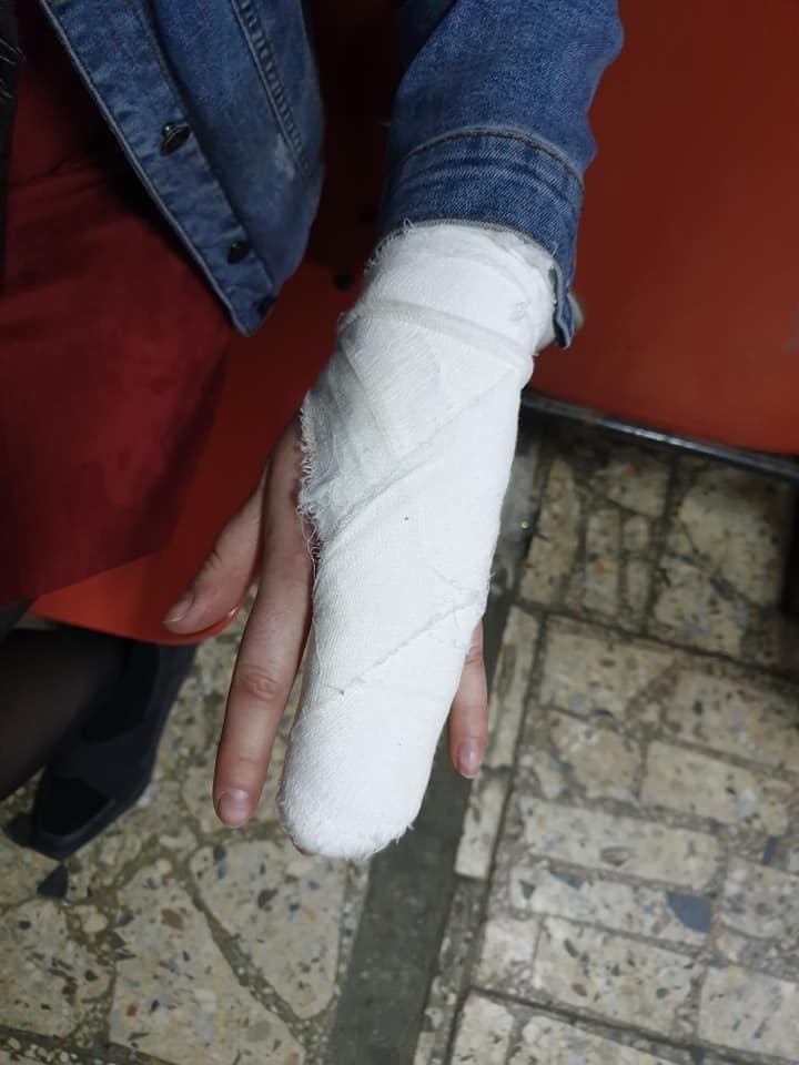 В Киеве банды подростков систематически избивают людей: стало известно о новых случаях (фото, видео)