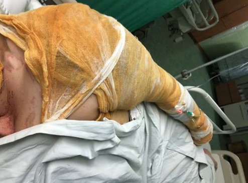 В сети показали фото чиновницы-борца с сепаратизмом из Херсона, которую облили кислотой
